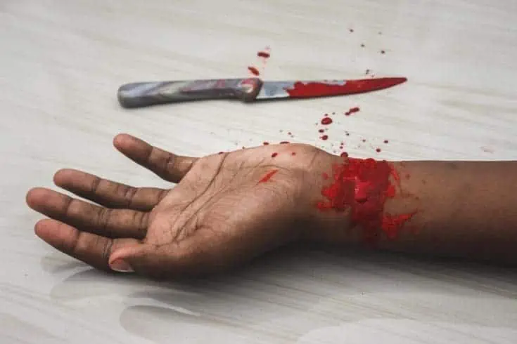 Homecoming Blood - An Exciting Mystery 3 Suicide. blood on wrist with knife laying besides