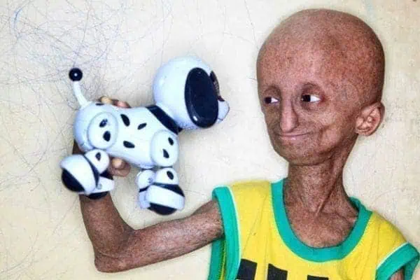 Story of an Ill Boy Who Inspires by His 'Life-Power' 2