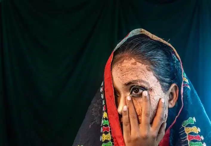 What Does It Mean to Be A Liberal in India ? 4 Acid attack on Indian woman