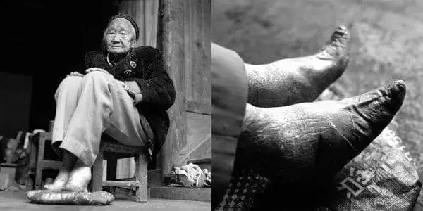 Last Glimpses of Foot Binding Tradition 2