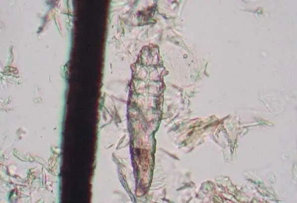 Tiny Mites on Your Face While You Sleep? Definitely Not 2