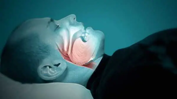 Sleep Apnea: Death During Sleeping? 1
