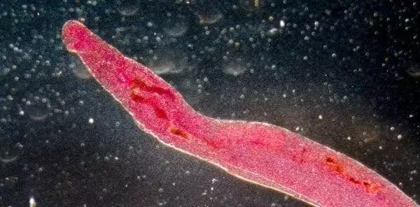 weird disease