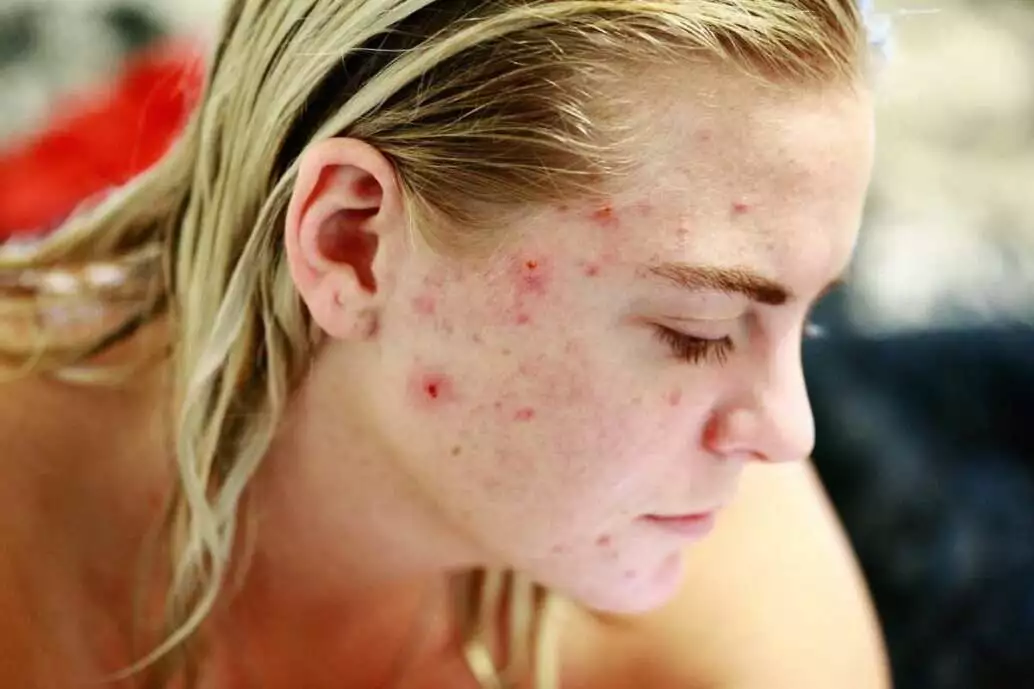 Skin problems