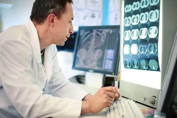 Doctor looking at ct scan.