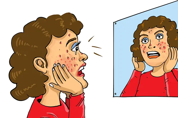 side effects of bleaching face
