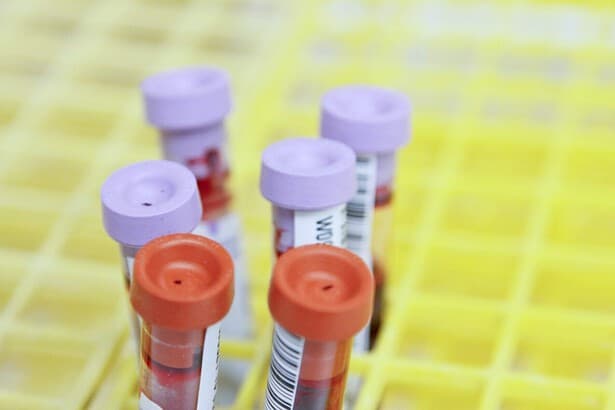 What causes Low Creatinine