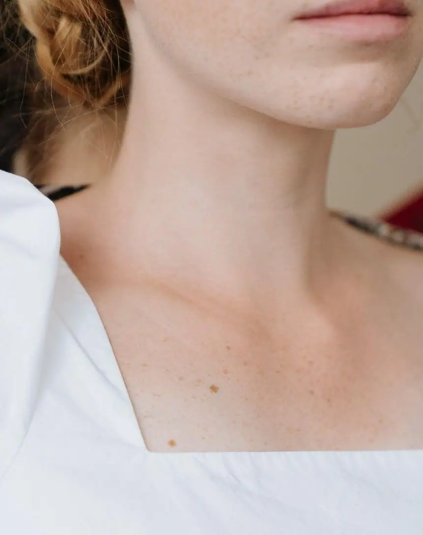 How to get rid of neck lines