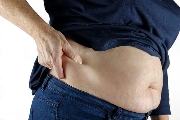 How To Avoid Loose Skin After Weight Loss