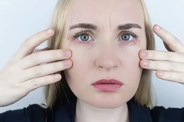 how to soothe irritated skin around the eyes