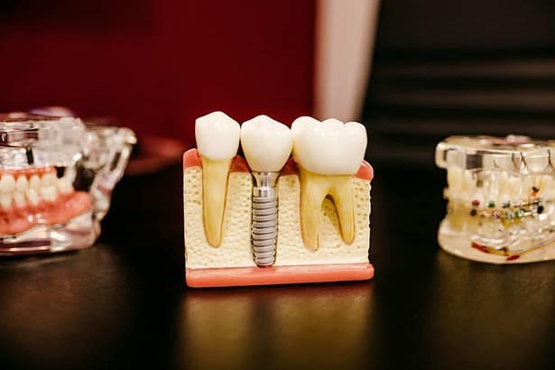 how to get food out of wisdom tooth hole