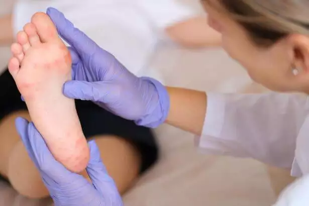 Doctor examining foot of child with red itchy rashes in clinic closeup.