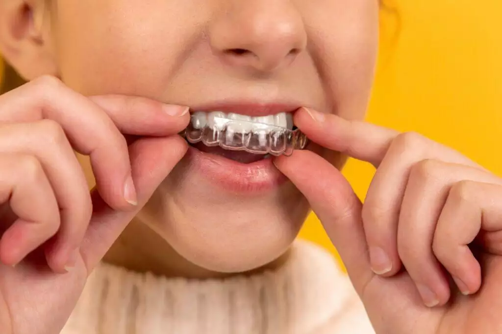 How To Know If You Need Braces: A Comprehensive Guide