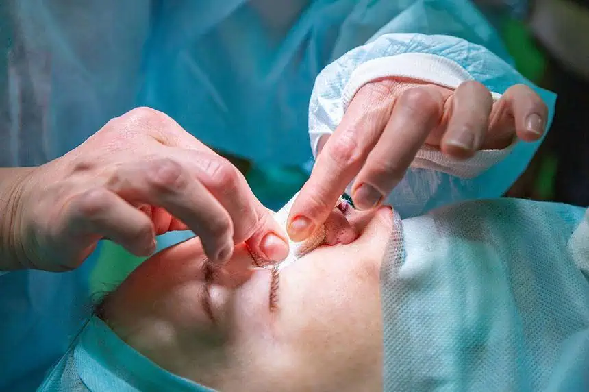 What Should You Know About Radiesse Nose Lift? 1