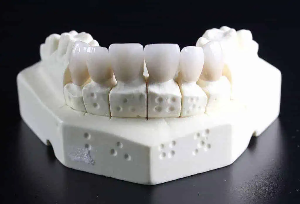 how to know if you have wisdom teeth
