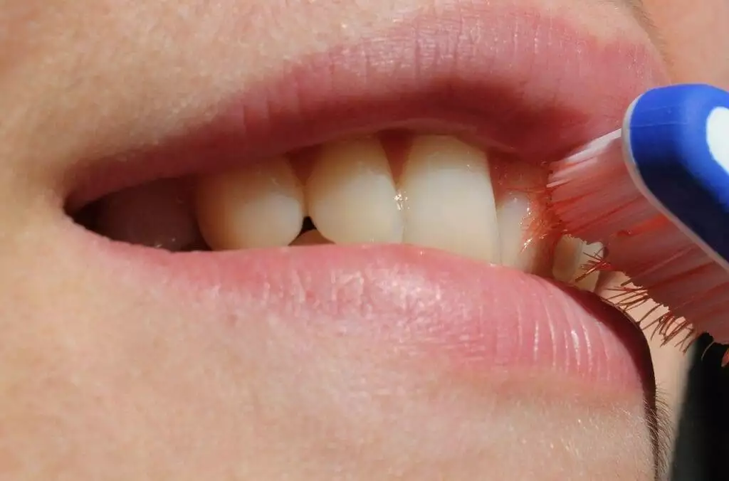How to Identify Gum Disease: Top Tips for Healthy Gums 2 How to Know if You Have Gum Disease
